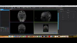 MPHY0026: Surface Rendering Example