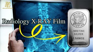 Silver Recovery from X-RAY Radiology Films .Silver Recovery