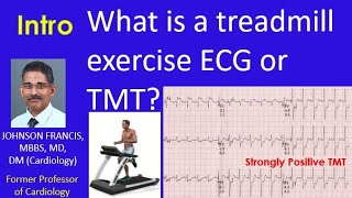 What is a treadmill exercise ECG or TMT? Intro