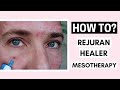 Rejuran Healer Skin Booster Mesotherapy Before And After Ft. @Vanidiy