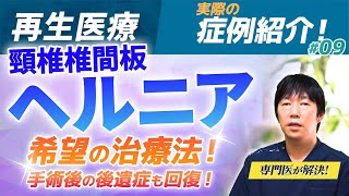 【再生医療】頚椎椎間板ヘルニアの新しい治し方！治療不可も諦めないで！【医師が解説】