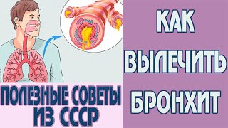 Как вылечить бронхит в домашних условиях у взрослых. Хронический и острый бронхит. Лечение бронхита