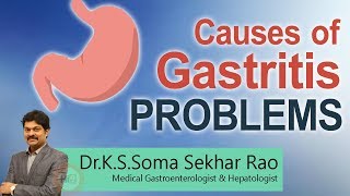 Hi9 | Causes of Gastritis Problems | Dr.K.S.Soma Sekhar Rao | Medical Gastroenterologist