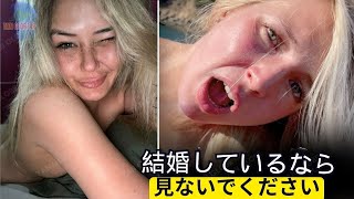 18人のハリウッド美女たちが明かす！手術後の魅惑的なカーヴがあなたを完全に狂わせる |  旅のドキュメンタリー