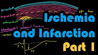 Ischemia, Infarction, and the Waveforms Q through U, Part 1: How to Read an EKG Curriculum