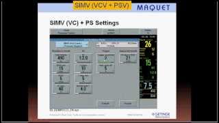 Mechanical ventilation -10- SIMV (English)