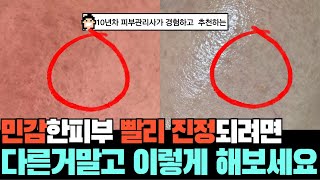 민감한 피부라면 다른거말고 이 3가지 해보세요!