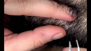 PLUCKING BEARD HAIRS