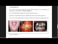 l6 oh anomalies of tooth development