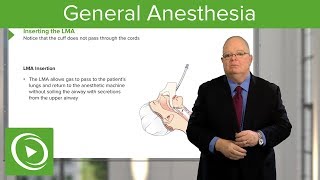 General Anesthesia – Anesthesiology | Lecturio