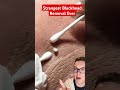 strangest blackhead removal ever what is this shorts