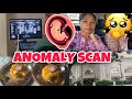 Ani Anomaly Scan Report at 22weeks || Doctor Tm Sakha Baby Ni Bagui 🥹|| @PayelTiprasaOfficial