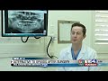 Local oral surgeons fight opioid epidemic with non-opioid alternative