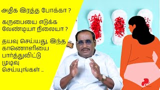 அதிக இரத்த போக்கா ? கருபையை எடுக்க வேண்டியா நிலையா ?