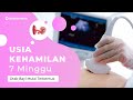 Hamil 7 Minggu, Otak Bayi dan Tali Pusat Mulai Terbentuk | DokterSehat