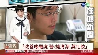 【台語新聞】戴口罩悶出痘 醫:痘痘看診者多2成 | 華視新聞 20200612