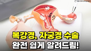 복강경과 자궁경 수술방법과 기구 (#복강경수술 #자궁경수술 #자궁적출술)