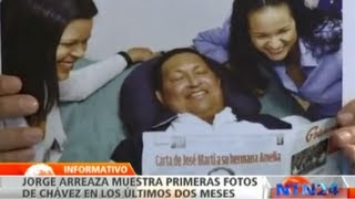 Primeras imágenes de Chávez tras operación en Cuba