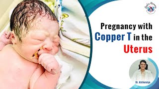 Is it dangerous? | Pregnancy with copper T in the uterus | Doctor mommies