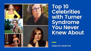 Top 10 Celebrities with Turner Syndrome You Never Knew About