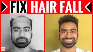How to Stop Hair fall Naturally and ReGrow Faster Naturally | Tamil | Soundar's Fashion