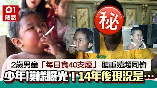 2歲印尼男孩吸煙成癮「每日食40支煙」震撼全球　14年後驚人現況曝光｜01熱話