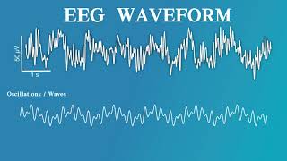 EEG for Anesthesiology - Part 2: The EEG Waveform and Spectrogram