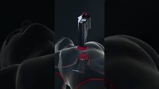 corpuls cpr