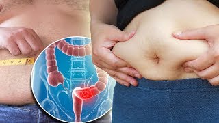 How to Get Rid of Your Stomach Bloating Naturally?