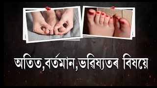 যদি আপোনাৰো ভৰিৰ ধৰণ এনেধৰণৰ তেন্তে আপুনি বহুত ভাগ্যশালী!