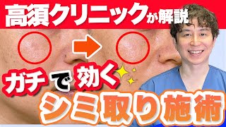 【高須クリニックが解説】そばかすや肝斑が薄くなる！パターン別のシミ取り方法を解説