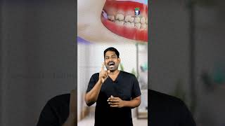 வலி இல்லாத மேல் ஞானப்பல்லை ஏன் எடுக்க வேண்டும்? Why to extract upper wisdom tooth? Dr.Karthikeyan