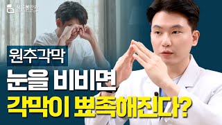 눈을 비비면 내 각막이 뾰족해진다?👁️