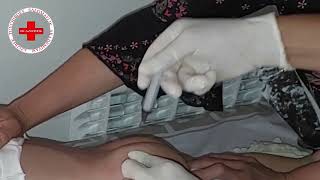 intramuscular injection for baby. buttock injection