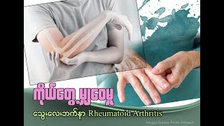 သွေးလေးဘက်နာ (Rheumatoid Arthritis)