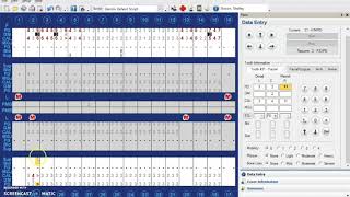 Bleeding On Probing In Dentrix