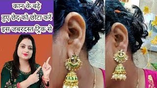 हमेशा के लिए सिर्फ 10 सेकंड में कान के छेद को छोटा करें/ear hole closing in hindi/ear hole closing