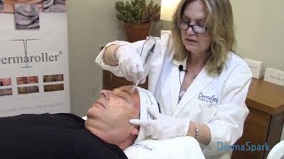 Dermaroller® Micro-needling - eDermaStamp Training Video