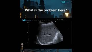 Ultrasound Detective: What is the problem here? #ultrasoundquiz #abdominalultrasound #123sonography