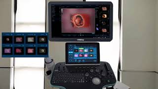 Mindray-iLive Pro Demonstration | Ultrasound Tutorials