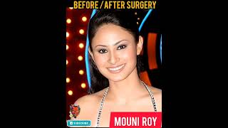 Mouni Roy Face 😱 Before Surgery 😱 OMG #shorts #youtubeshorts #viral #trending