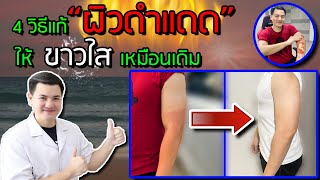 ผิวดำแดด แก้ยังไง ? ผิวคล้ำจากแดด ผิวไหม้แดด ทำไงให้กลับมาขาว | เภสัชเกรียน