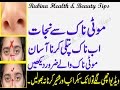Download Motti Naak Ko Patli Kerne ka Asan Nuskha Shartiya in urdu hindi In Mp4 3Gp Full HD Video