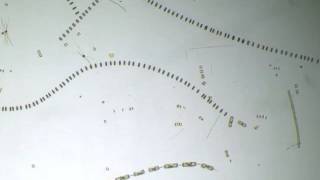 Diatoms multiplying under the microscope