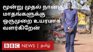 Ghana's Tallest Man: “எனக்கு அறுவை சிச்சை செய்தால்தான், என் வளர்ச்சி நிற்கும்”