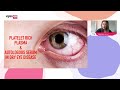 treating advanced dry eye disease with platelet rich plasma