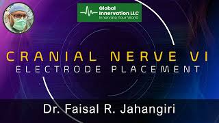 Cranial Nerve VI electrode placement