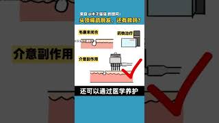 【毛髮知識】頭頂稀疏、脫髮怎麼辦？這樣做可以生髪！雍禾植髮|徐魯醫師