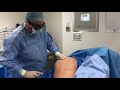 cellulaze laser for permanent cellulite reduction by dr ayham al ayoubi.