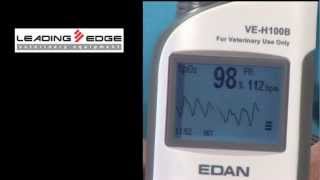 Edan VE-H100B Pulse Oximeter from Leading Edge